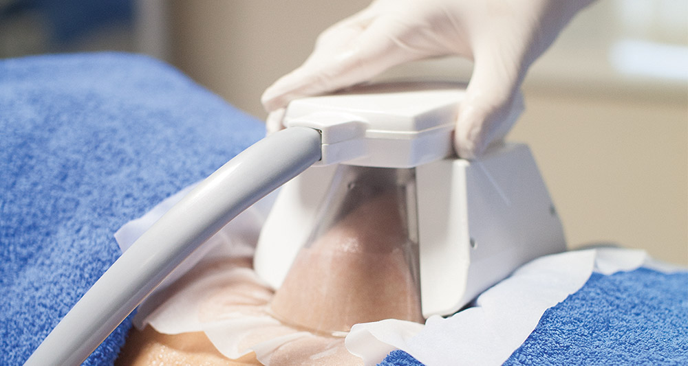 How Fat Freezing and HIFU Work Together? 2 Multiple Areas in One Session HIFU and Fat Freezing Waltham Abbey