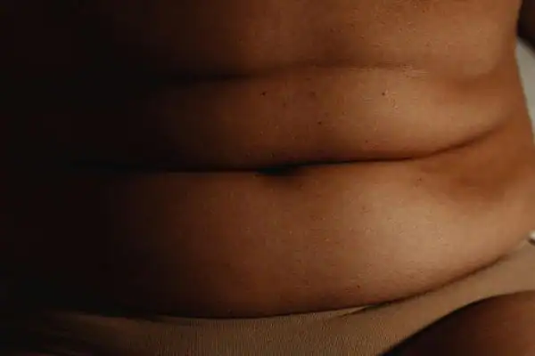 The Hidden Connection: How Stress Shapes Your Fitness and Body Composition 3 image of what stress can do on the stomach area and how Lipo 360 Waltham Abbey can help to change your body shape.
