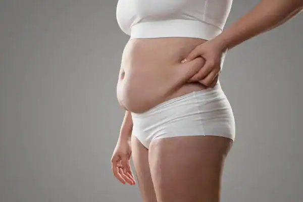 Image of stress belly Waltham Abbey How Lipo 360 can help manage your symptoms
